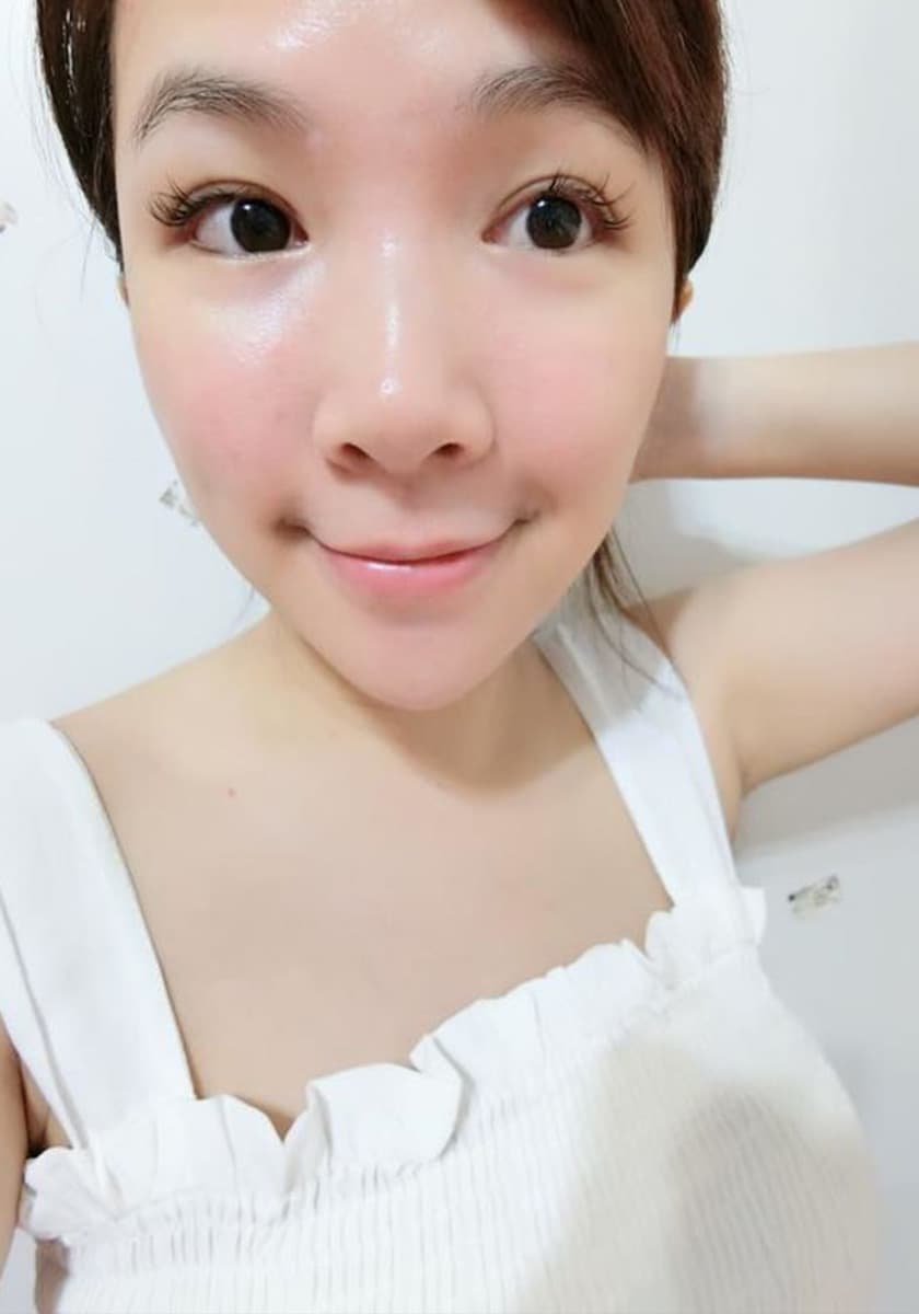 picocare皮秒雷射